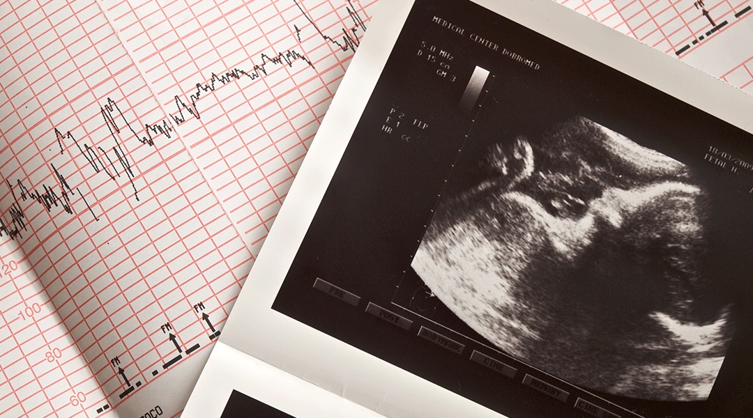 O ecocardiograma fetal deve ser feito com quantas semanas de gestação ...